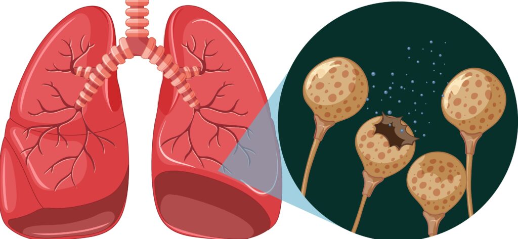 Chronic Obstructive Pulmonary Disease